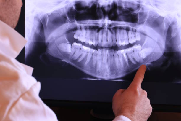 Best Emergency Treatment for Oral Infections in Olympia, WA